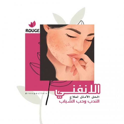 جلسة انفني للوجه