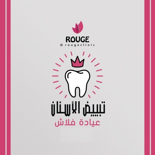 تبييض أسنان عيادة فلاش